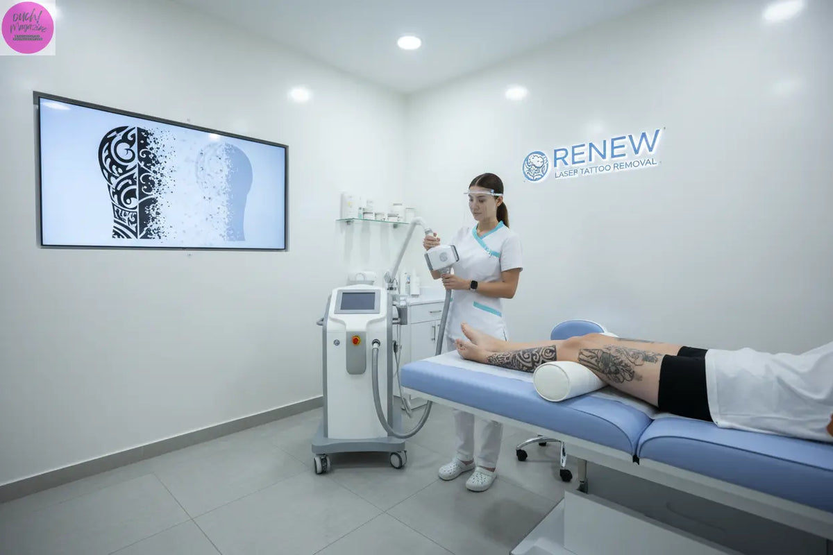 Tattoo Removal